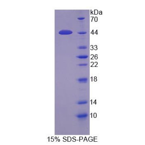 SDS-PAGE analysis of Protease, Serine 23 Protein.