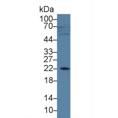 Amelogenin, X-Linked (AMELX) Antibody