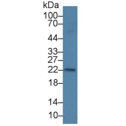 Amelogenin, X-Linked (AMELX) Antibody