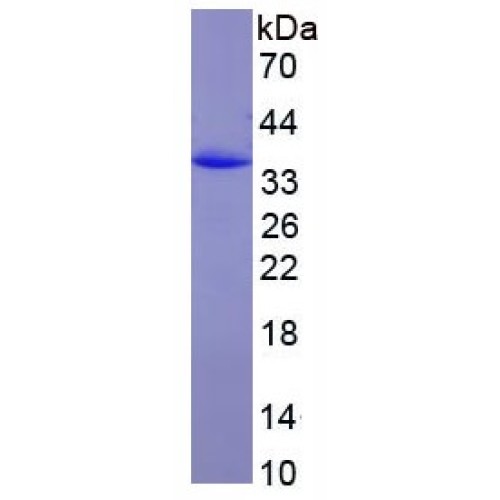 SDS-PAGE analysis of recombinant Rat CRLF1 Protein.