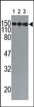 The ACE Antibody (Cat. No. 250450) is used in Western blot to detect ACE in mouse lung (1), liver (2), and adrenal glands (3) tissue lysates.