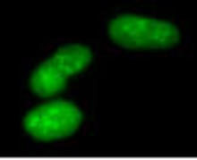 The Dimethylated Arginine Antibody (Cat. No. 251132) is used at 5 ug/ml in immunofluorescence to detect dimethylated proteins in pFA-fixed human melanoma cells.