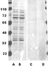 The Dimethylated Arginine Antibody (Cat. No. 251132) is used in Western blot to detect dimethylated proteins in human melanoma cell lysates (lanes A, B). Control with pre-incubation with dimethylated arginine (lanes C, D).