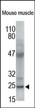 Collagen I Antibody (Cat. No. 251221) is used in Western blot at 1:200 to detect Collagen I in mouse muscle lysates.