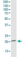 Western Blot (Cell lysate)