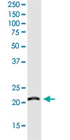 Western Blot (Cell lysate)