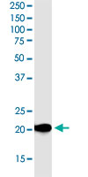 Western Blot (Cell lysate)