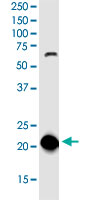 Western Blot (Cell lysate)