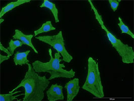 Immunofluorescence