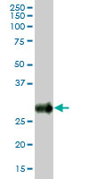 Western Blot (Tissue lysate)