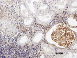 Immunohistochemistry (Formalin/PFA-fixed paraffin-embedded sections)