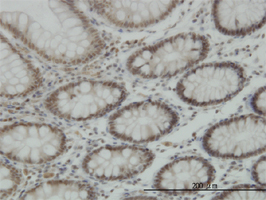 Immunohistochemistry (Formalin/PFA-fixed paraffin-embedded sections)