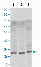 Western Blot (Cell lysate)