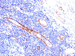 Immunohistochemistry