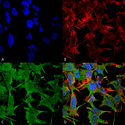 Immunocytochemistry