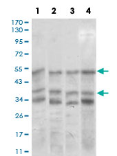 Western Blot (Cell lysate)