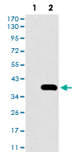 Western Blot (Transfected lysate)