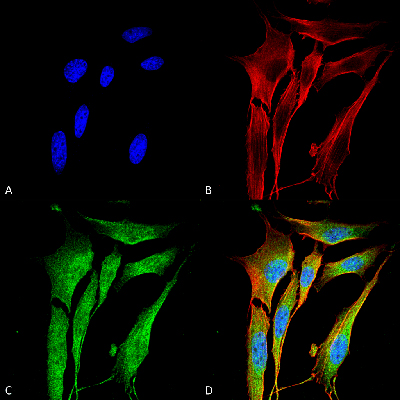 Immunocytochemistry