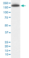 Western Blot (Cell lysate)