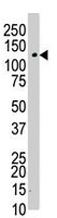 Western Blot (Tissue lysate)