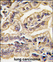 Immunohistochemistry (Formalin/PFA-fixed paraffin-embedded sections)