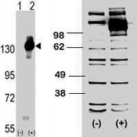 Western Blot (Transfected lysate)