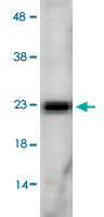 Western Blot (Tissue lysate)