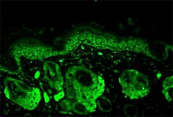 Immunofluorescence