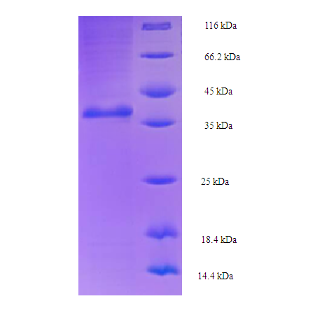 Protein SDS-PAGE