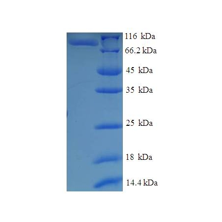 Protein SDS-PAGE