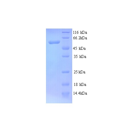 Protein SDS-PAGE