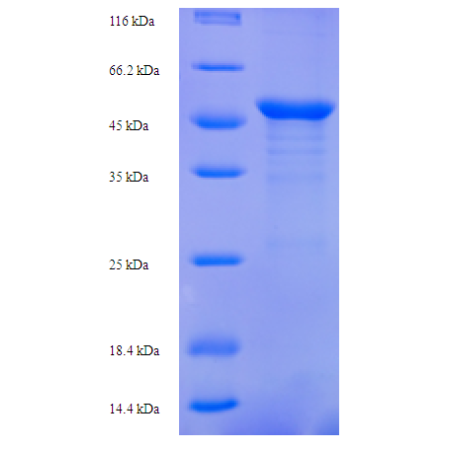 Protein SDS-PAGE