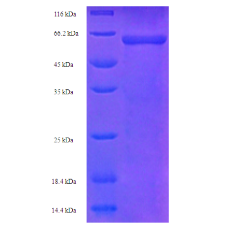 Protein SDS-PAGE