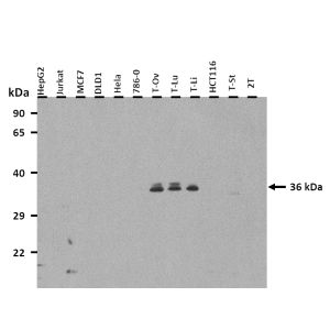 Western Blot