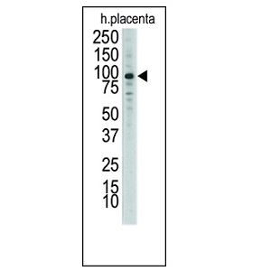 placenta