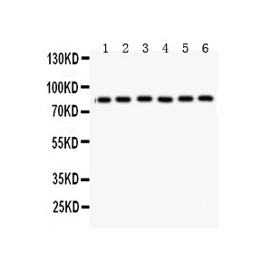 Rat Cardiac Muscle Tissue Lysate, Rat Kidney Tissue Lysate, Mouset Cardiac Muscle Tissue Lysate, HELA Whole Cell Lysate, COLO320 Whole Cell Lysate, A549 Whole Cell Lysate