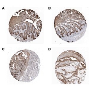 Different human normal tissues (A: Rectum; B: Small Intestine; C: Stomach) or cancer tissues (D: Colorectal cancer)