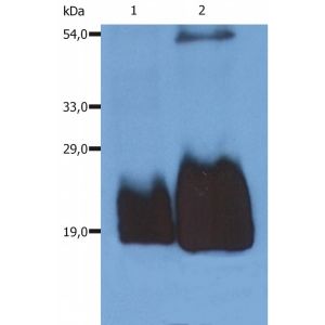 Human peripheral blood T cell