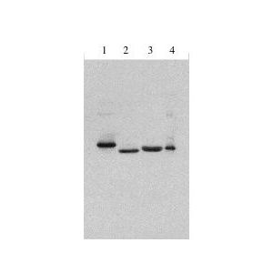 1] Consensus IFN alpha, 2] IFN alpha 2a, 3] IFN beta 1 b, 4] IFN alpha 1