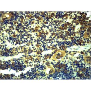 Immunohistochemistry