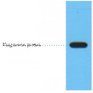 Western Blot