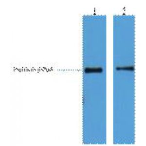 Western Blot