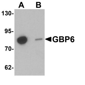 HeLa cell lysate