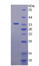 Human Apolipoprotein CIII protein, His and GST tag. GTX03431-pro