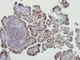 Anti-MDM2 antibody used in IHC (Paraffin sections) (IHC-P). GTX100531