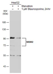 Anti-MDM2 antibody used in Western Blot (WB). GTX100531