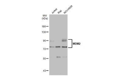 Anti-MDM2 antibody used in Western Blot (WB). GTX100531