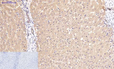 Anti-beta Catenin antibody [4F2] used in IHC (Paraffin sections) (IHC-P). GTX34339