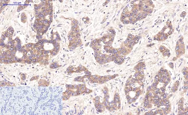 Anti-beta Catenin antibody [4F2] used in IHC (Paraffin sections) (IHC-P). GTX34339