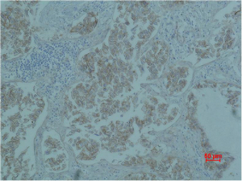 Anti-beta Catenin antibody [4F2] used in IHC (Paraffin sections) (IHC-P). GTX34339